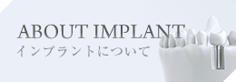 ABOUT IMPLANT・インプラントについて