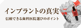 インプラントの真実・信頼できる歯科医院選びのポイント
