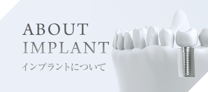 ABOUT IMPLANT・インプラントについて