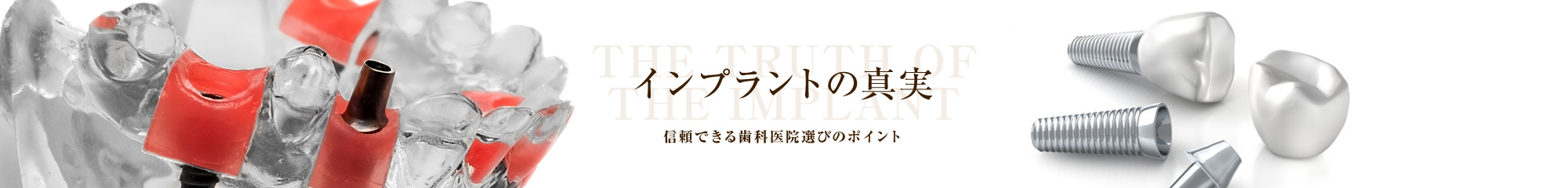 インプラントの真実・信頼できる歯科医院選びのポイント・THE TRUTH OF THE IMPLANT